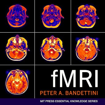 fMRI - undefined