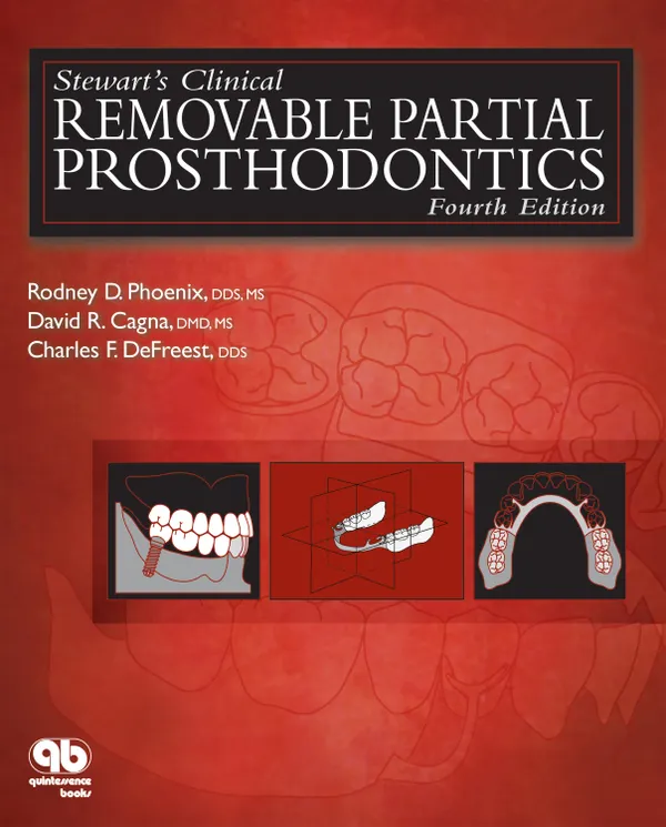 Stewart's Clinical Removable Partial Prosthodontics : Fourth Edition