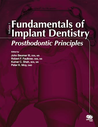 Fundamentals of Implant Dentistry, Volume 1: Prosthodontic Principles - undefined