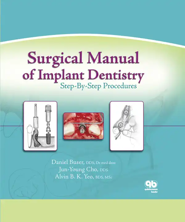 Surgical Manual of Implant Dentistry : Step-by-Step Procedures