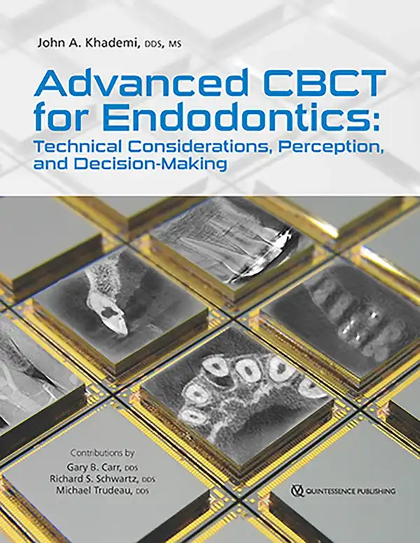 Advanced CBCT for Endodontics : Technical Considerations, Perception, and Decision-Making