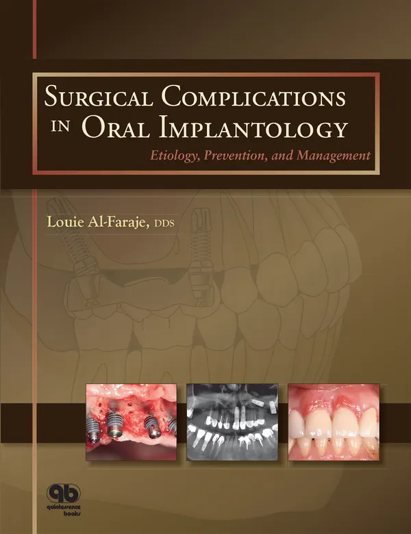 Surgical Complications in Oral Implantology : Etiology, Prevention, and Management
