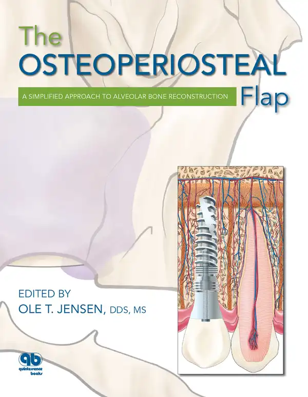The Osteoperiosteal Flap : A Simplified Approach to Alveolar Bone Reconstruction