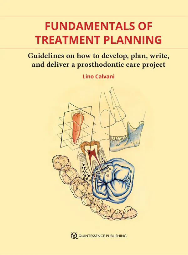 Fundamentals of Treatment Planning : Guidelines on How to Develop, Plan, Write, and Deliver a Prosthodontic Care Project