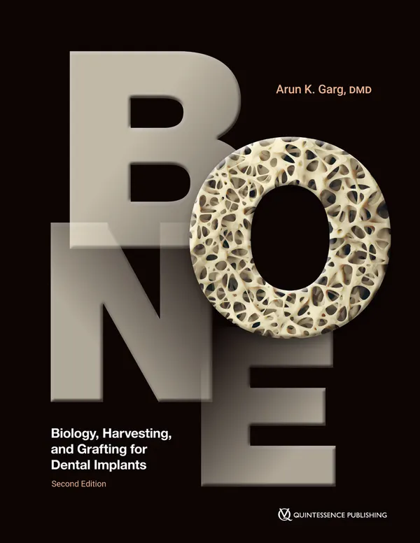 Bone : Biology, Harvesting, and Grafting for Dental Implants, 2nd Edition