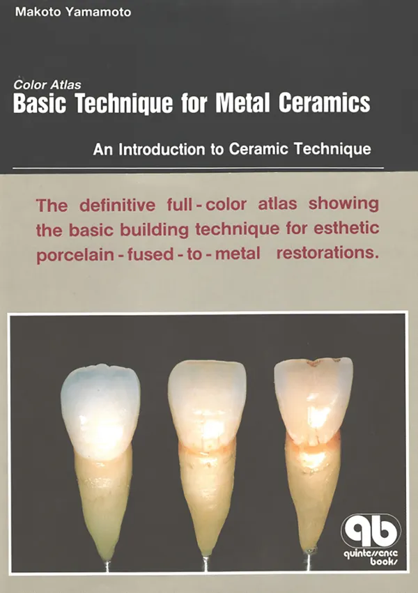 Color Atlas Basic Technique for Metal Ceramics : An Introduction to Ceramic Technique