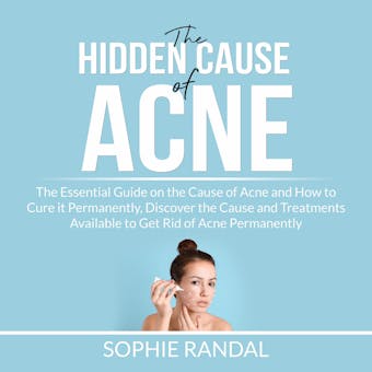 The Hidden Cause of Acne: the Essential Guide on the Cause of Acne and How to Cure it Permanently, Discover the Cause and Treatments Available to Get Rid of Acne Permanently - Sophie Randal