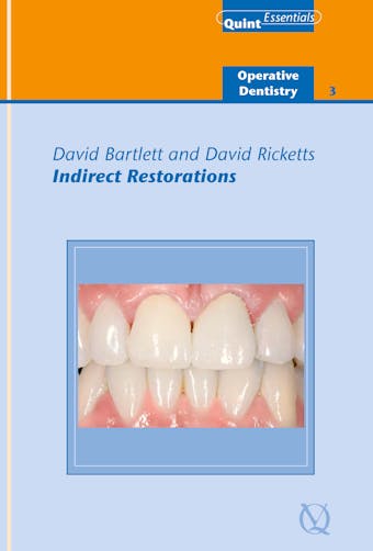 Indirect Restorations - David Bartlett, David Ricketts