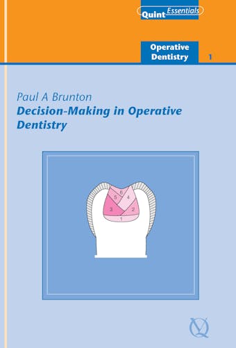 Decision-Making in Operative Dentistry - undefined