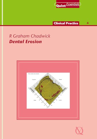 Dental Erosion - R. Graham Chadwick