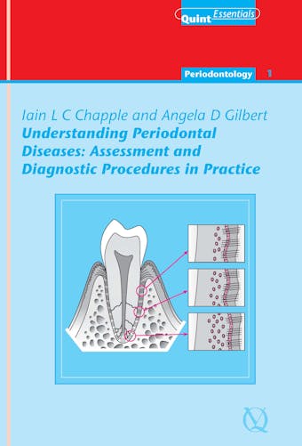 Understanding Periodontal Diseases: Assessment and Diagnostic Procedures in Practice - Angela Gilbert, Iain L. C. Chapple