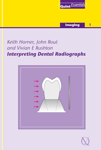 Interpreting Dental Radiographs - John Rout, Vivian E. Rushton, Keith Horner