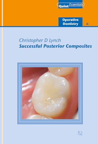 Successful Posterior Composites - Christopher D. Lynch