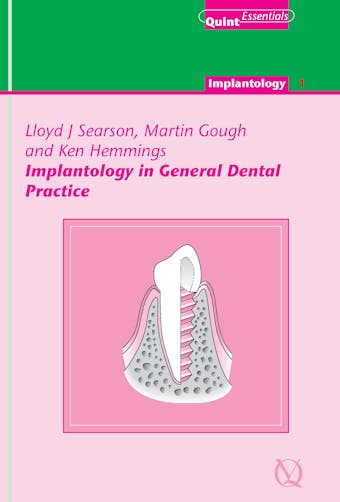 Implantology in General Dental Practice - undefined
