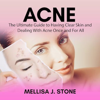 Acne: The Ultimate Guide to Having Clear Skin and Dealing With Acne Once and For All - Mellisa J. Stone