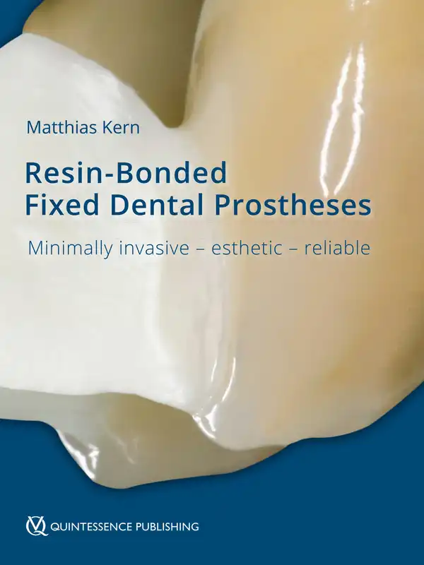 Resin-Bonded Fixed Dental Prostheses : Minimally invasive – esthetic – reliable