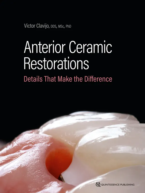 Anterior Ceramic Restorations : Details That Make the Difference