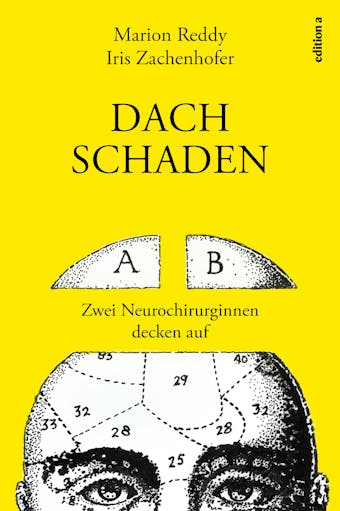 Dachschaden: Zwei Neurochirurginnen decken auf