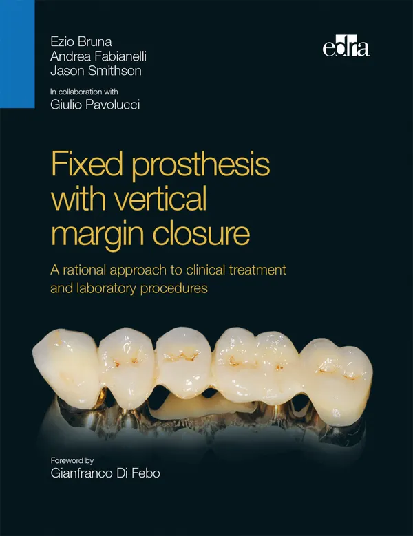 Fixed prosthesis with vertical margin closure : A rational approach to clinical treatment and laboratory procedures