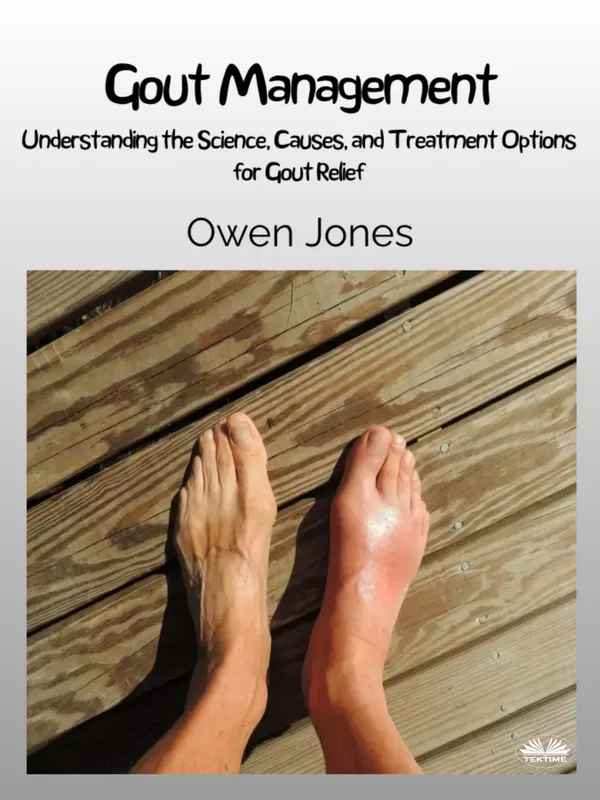Gout Management : Understanding The Science, Causes, And Treatment Options For Gout Relief