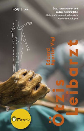 Ötzis Leibarzt: Ötzi, Tutanchamun und Kriminalfälle. Heinrich Schwazer im Gespräch mit dem Pathologen - Eduard Egarter Vigl