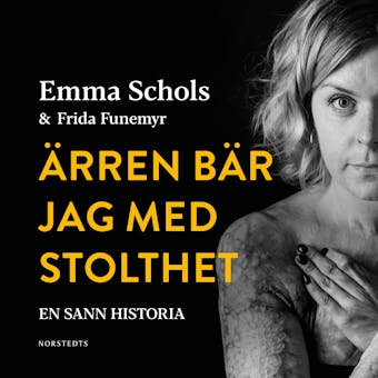 Ärren bär jag med stolthet: Branden i Edsbyn och livet efteråt