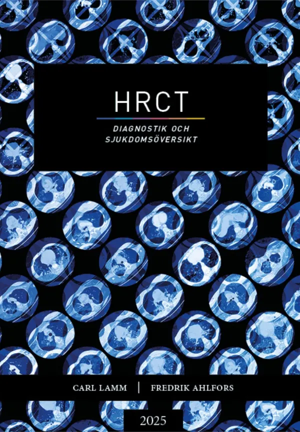 HRCT – Diagnostik och sjukdomsöversikt 