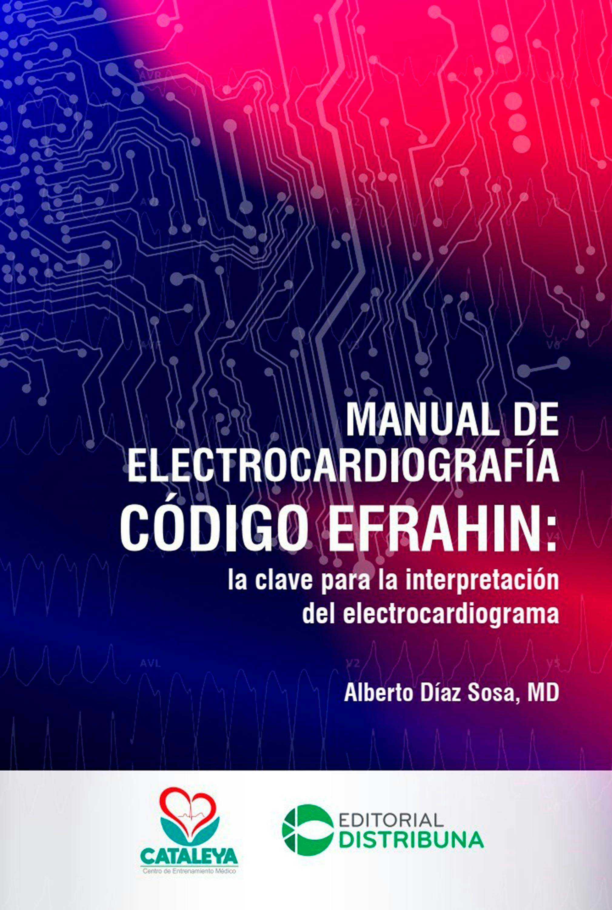 interpretación del electrocardiograma